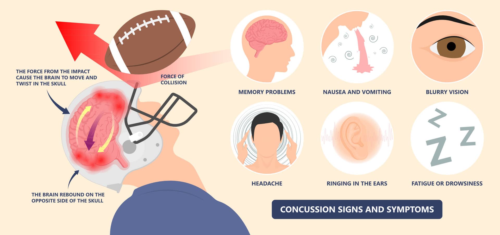Traumatic Brain Injury Concussion Signs and Symptoms